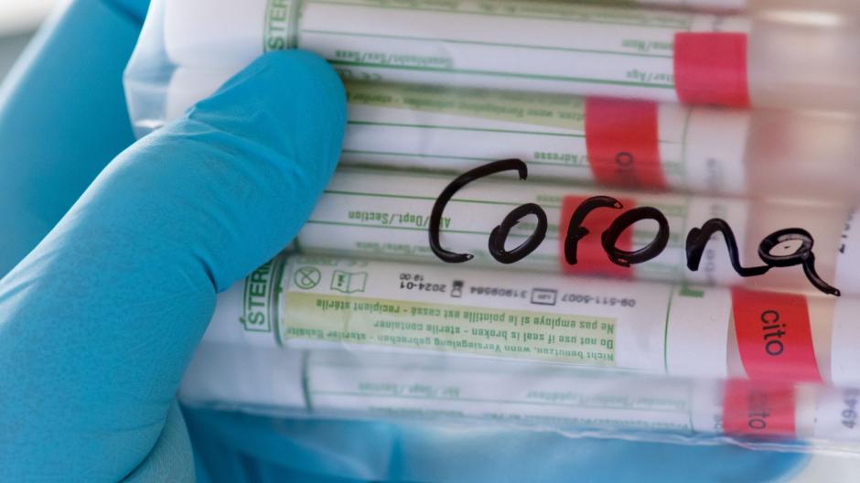 Auch sie werden noch lange nicht eingemottet: Corona-Tests sind in Schulen oder Kliniken weiter Voraussetzung.