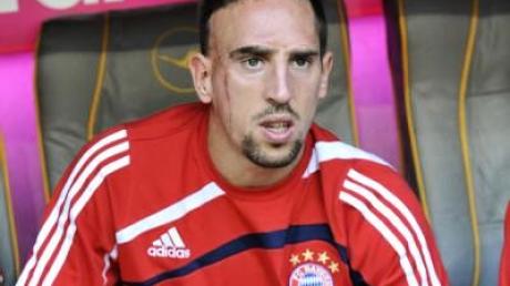 Rummenigge: Ribéry bleibt bei Bayern