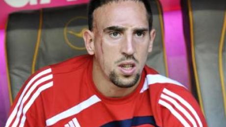 Ribéry-Comeback erst gegen Hertha geplant